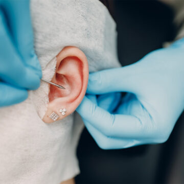 Ear Piercing Infection