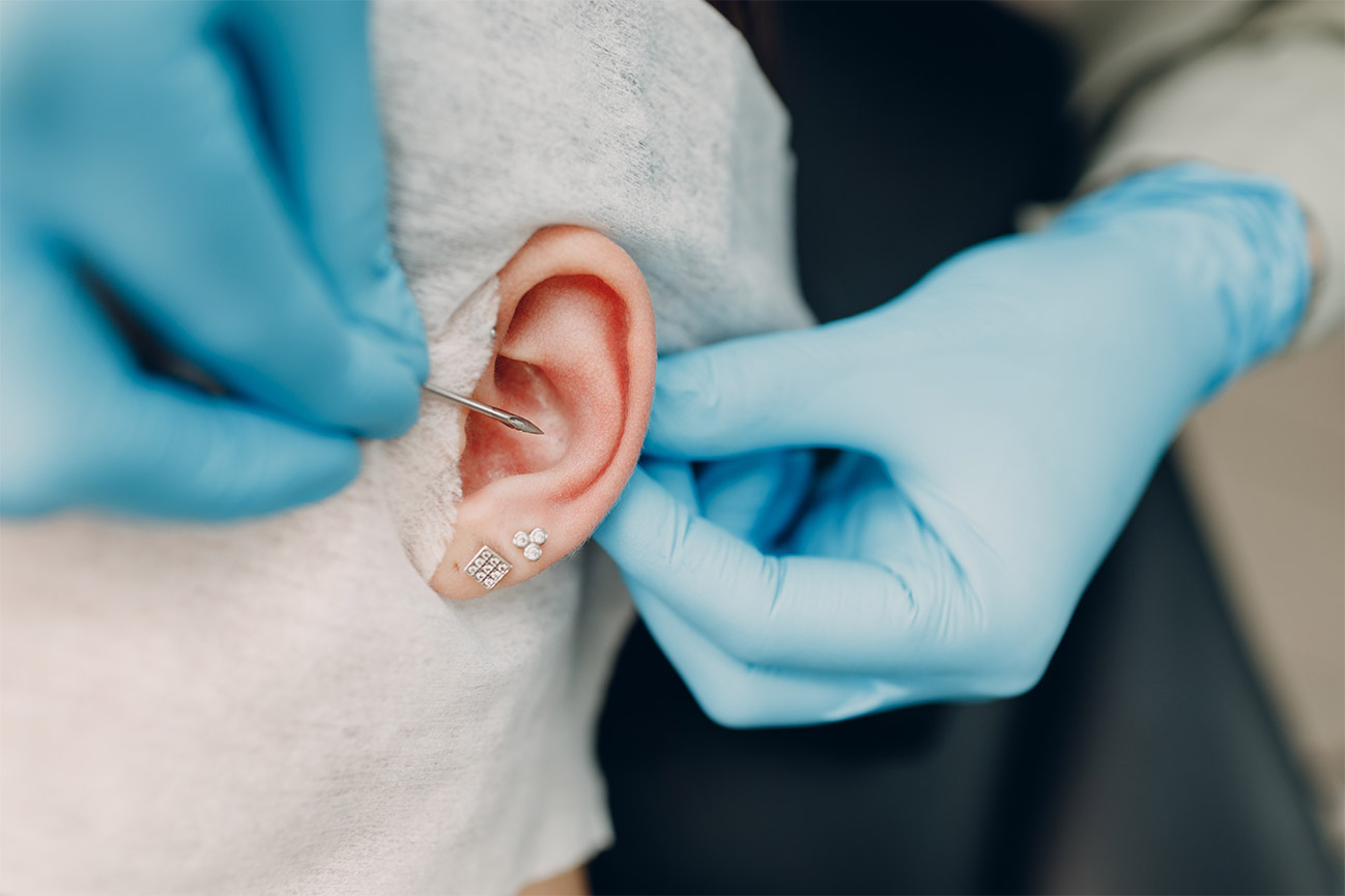 Ear Piercing Infection