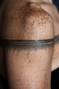 Tattoo Over Freckles: How Ink Reacts to Spotted Skin
