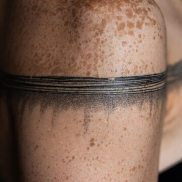 Tattoo Over Freckles: How Ink Reacts to Spotted Skin